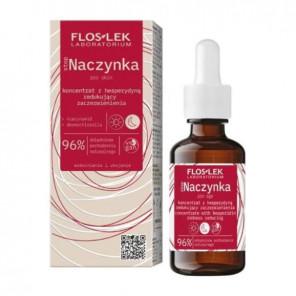 FLOS-LEK stopNaczynka, Koncentrat z hesperydyną redukujący zaczerwienienia, 30 ml - zdjęcie produktu