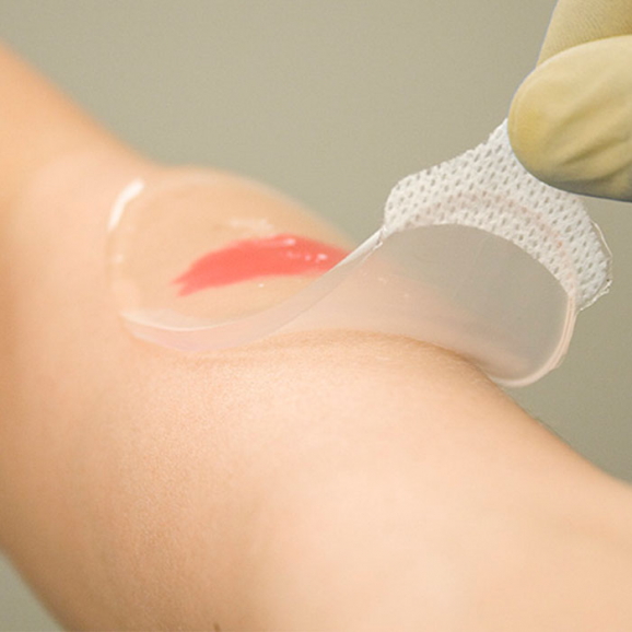 Aqua-Gel opatrunek hydrożelowy (5,5 x 11 cm) 5 szt. - zdjęcie produktu