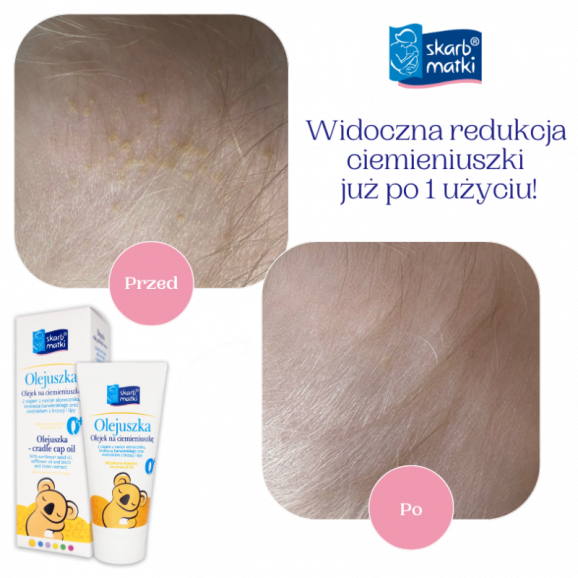 Skarb Matki Olejuszka olejek na ciemieniuszkę (30 ml) - zdjęcie produktu