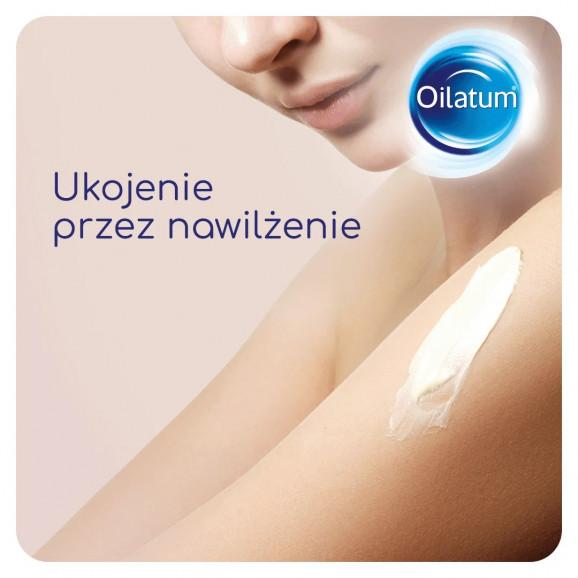 Oilatum Formuła Med, krem do skóry bardzo suchej, 150 g Oilatum Formuła Med, krem do skóry bardzo suchej, 150 g - zdjęcie produktu