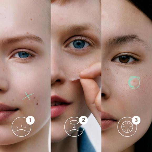 Cetaphil Blemish Prone 6 Hour Fast Clear Pimple Patch – plastry na wypryski (24 sztuki) - zdjęcie produktu