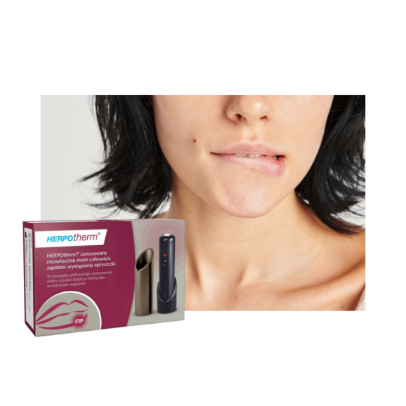Herpotherm, urządzenie do miejscowego leczenia opryszczki, 1 szt. - zdjęcie produktu