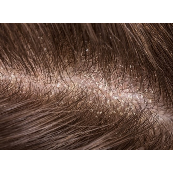 Seborh Szampon na łojotokowe zapalenie skóry głowy (200 ml) - zdjęcie produktu