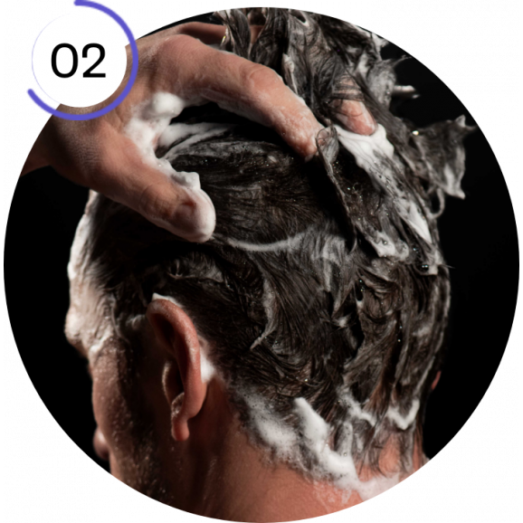 Loxon Pro Szampon przeciw wypadaniu włosów (150 ml) - zdjęcie produktu