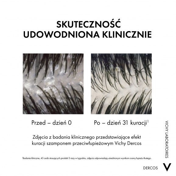 Vichy Dercos Anti-Dandruff DS 2 in 1 – szampon z odżywką (200 ml) - zdjęcie produktu