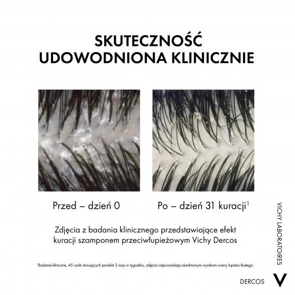 Vichy Dercos Anti Dandruff DS, szampon przeciwłupieżowy z odżywką 2w1 (390 ml) - zdjęcie produktu