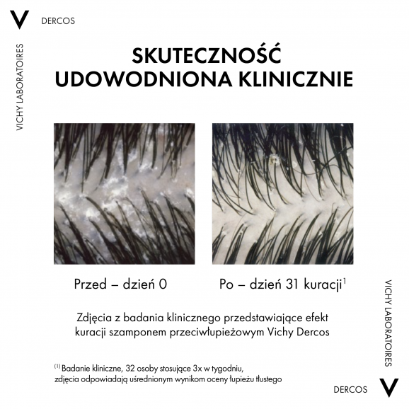Vichy Dercos Anti Dandruff Szampon przeciwłupieżowy, włosy normalne i przetłuszczające się, 200 ml - zdjęcie produktu