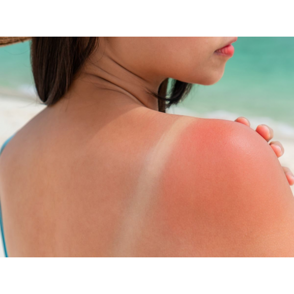 Bioderma Photoderm Gel-creme Apres-Soleil Łagodzący żel-krem przedłużający opaleniznę, 200ml Bioderma Photoderm Gel-creme Apres-Soleil Łagodzący żel-krem przedłużający opaleniznę, 200ml - zdjęcie produktu