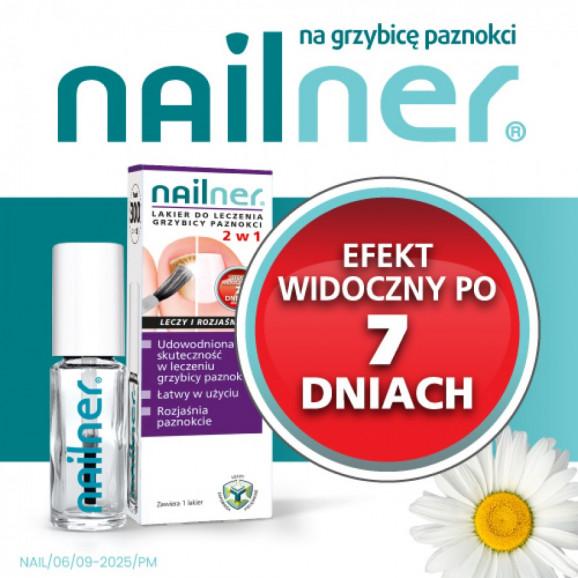 [31.05.2026] Nailner lakier do leczenia grzybicy paznokci 2 w 1, 5 ml – wyrób medyczny - zdjęcie produktu