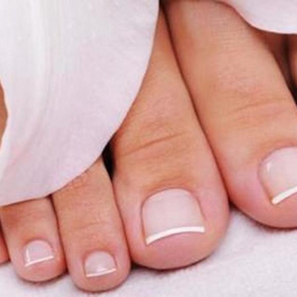 [31.05.2026] Nailner lakier do leczenia grzybicy paznokci 2 w 1, 5 ml – wyrób medyczny - zdjęcie produktu