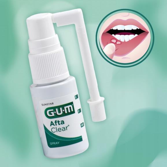 SUNSTAR GUM Afta Clear Spray do ust na afty i drobne rany (15 ml) – wyrób medyczny SUNSTAR GUM Afta Clear Spray do ust na afty i drobne rany (15 ml) – wyrób medyczny - zdjęcie produktu