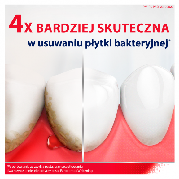 Parodontax Fluoride – pasta do zębów z fluorkiem (75 ml) Parodontax Fluoride – pasta do zębów z fluorkiem (75 ml) - zdjęcie produktu
