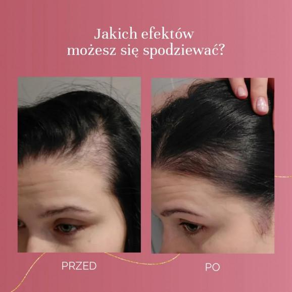 MyBestBeauty – suplement diety (90 kapsułek) - zdjęcie produktu
