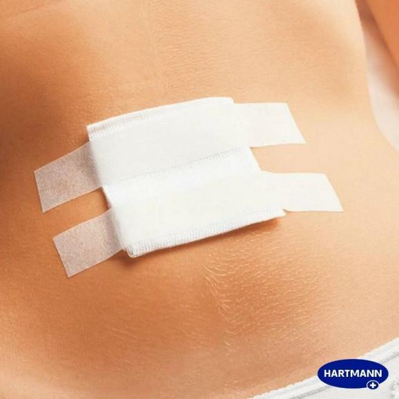 Hartmann Omnipor plaster włókninowy (przylepiec) 2,5 cm x 5 m – wyrób medyczny (1 rolka) Hartmann Omnipor plaster włókninowy (przylepiec) 2,5 cm x 5 m – wyrób medyczny (1 rolka) - zdjęcie produktu